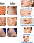 Theia Beautymaster Hydra 14 In 1 Diamond Peeling Hydro Microdermabrasion Oxygen Jet Aqua Facials Skin Care Cleaning Hydra Dermabrasion Facial Machine