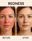 YouthGlow Advanced LED Facial Mask: Enhance Collagen & Skin Clarity