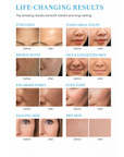 THEIA Aquastar 10-in-1 Microdermabrasion Hydro Facial Machine – Professional Skin Care & Deep Cleansing