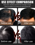 Theia Plus Hair Max Regrowth Laser Cap 150 Leds 660nm 850nm