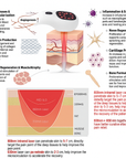 Deep Tissue Red Laser Therapy for Pain Relief and Recovery