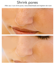 Theia ProLift RF Beauty Device: Advanced Facial Toning & Rejuvenation