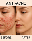 YouthGlow Advanced LED Facial Mask: Enhance Collagen & Skin Clarity