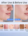 Professional Ultra-light LED Facial Mask – Red Light & Near-Infrared Skin Therapy