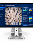 AI Scalp Analyzer T1 – Intelligent Hair & Scalp Analysis System