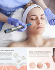 Ultima M8S Wireless Microneedling Pen – Professional Skin Renewal & Facial Care Device with 22 Needle Cartridges