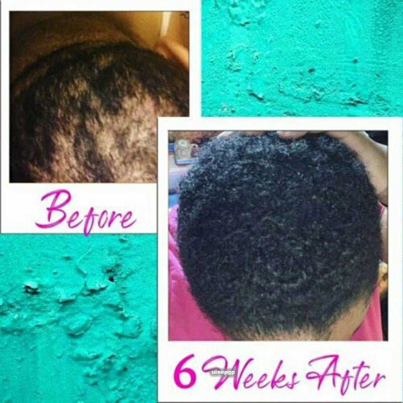 Anti Hair Loss Growth Serum