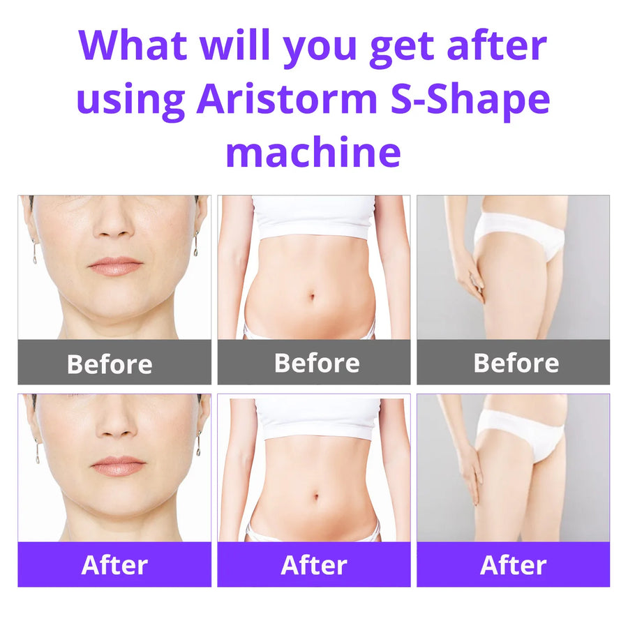 Ultimate Aristorm S Shape Machine – 30K Ultrasound Body Sculpting & Facial Lifting Device