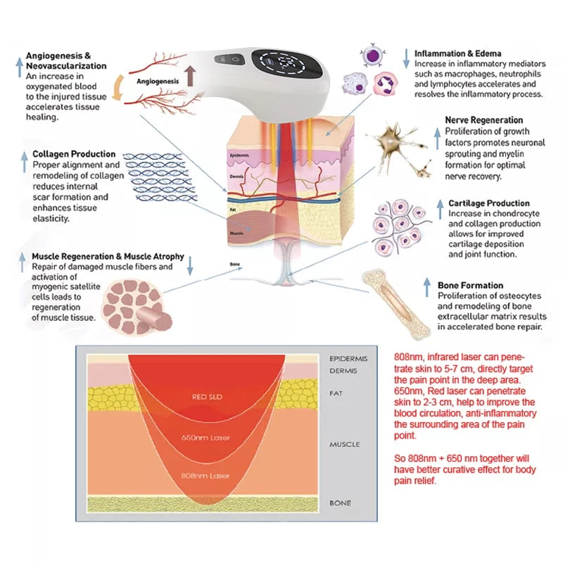 Deep Tissue Red Laser Therapy for Pain Relief and Recovery