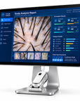 AI Scalp Analyzer T1 – Intelligent Hair & Scalp Analysis System