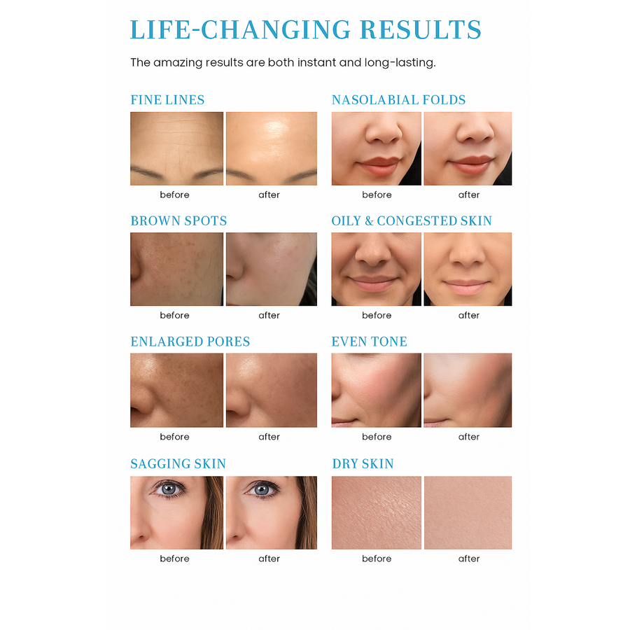 THEIA Aquastar 10-in-1 Microdermabrasion Hydro Facial Machine – Professional Skin Care & Deep Cleansing