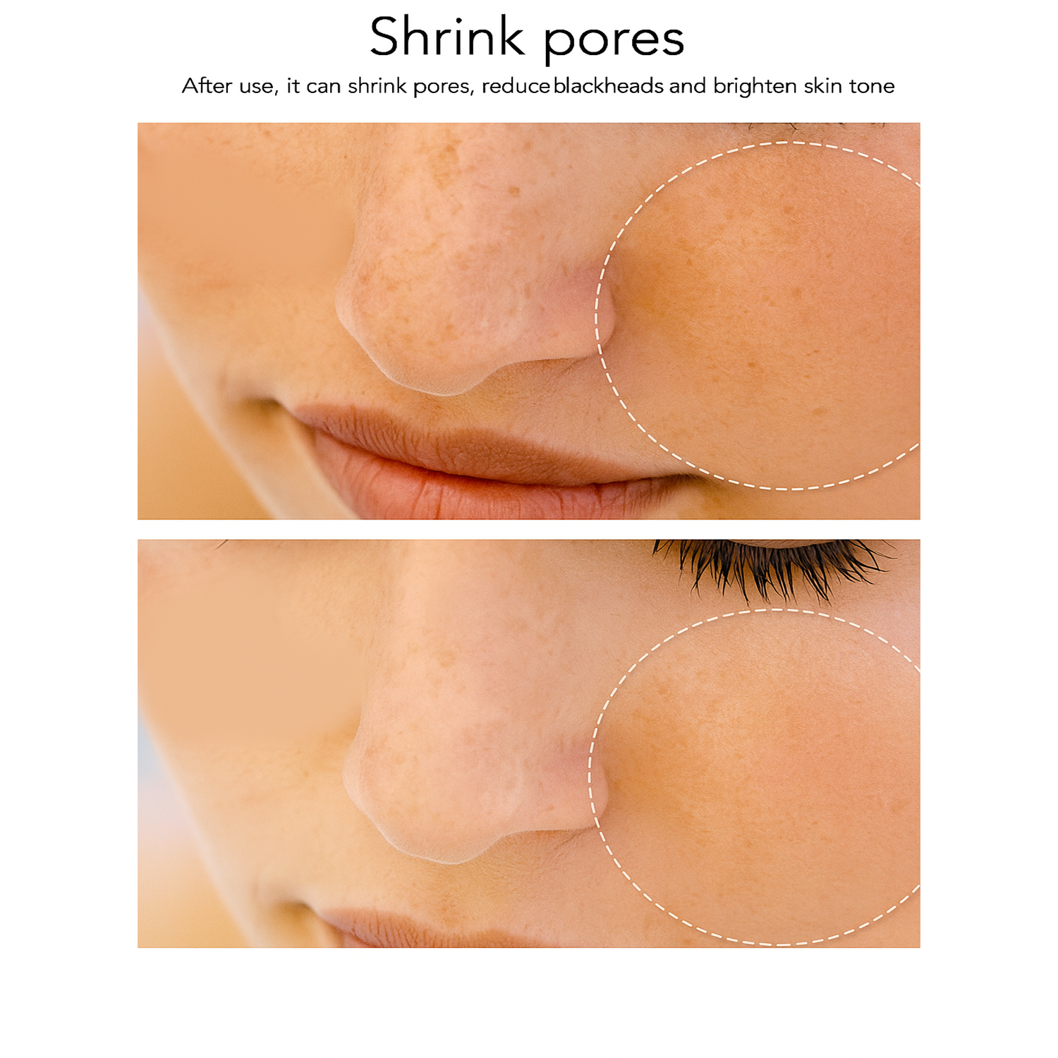 Theia ProLift RF Beauty Device: Advanced Facial Toning & Rejuvenation