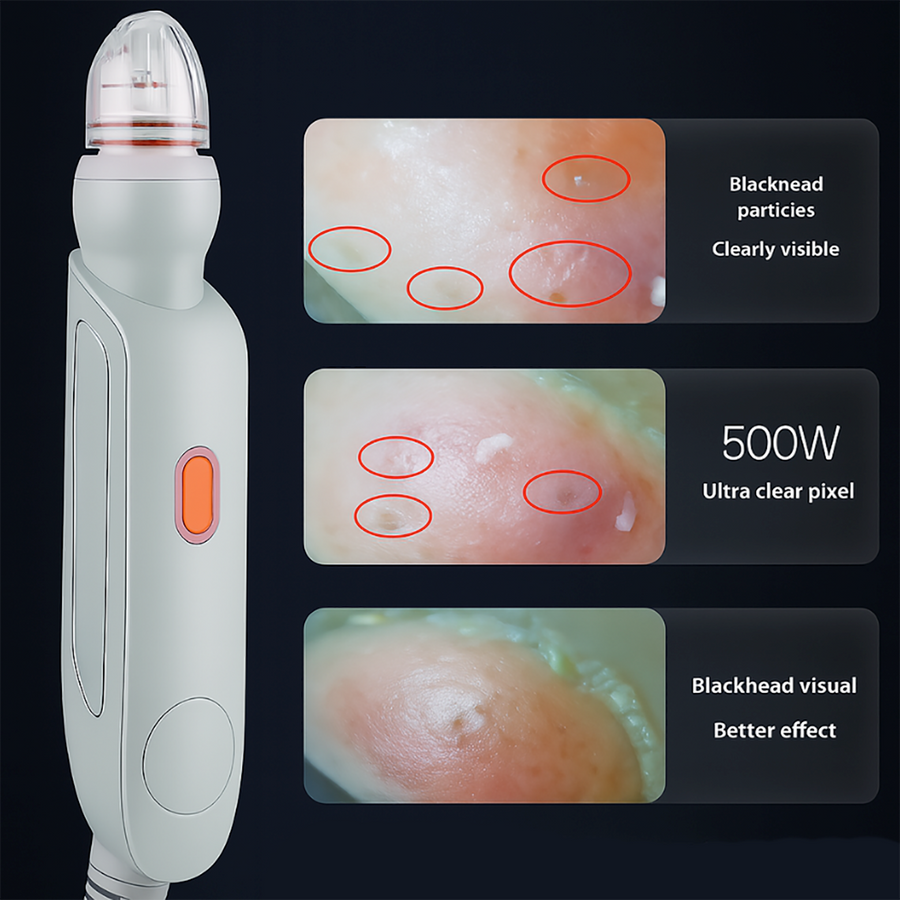 Theia ClearSkin Pro – 7-in-1 HD Camera Hydro Dermabrasion & Hydrogen Oxygen Facial System